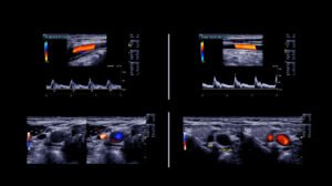 ultrasound doppler vascular testing near me